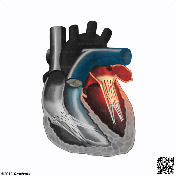 Apndice Atrial