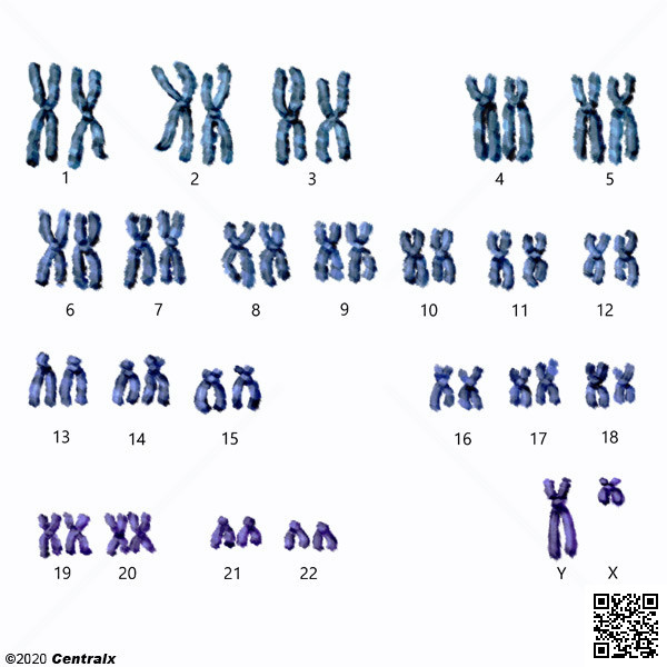 Cromossomos Humanos