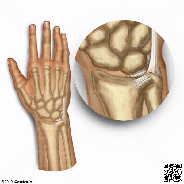 Fibrocartilagem Triangular