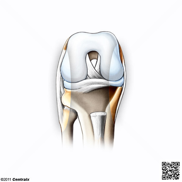 Ligamentos Colaterais