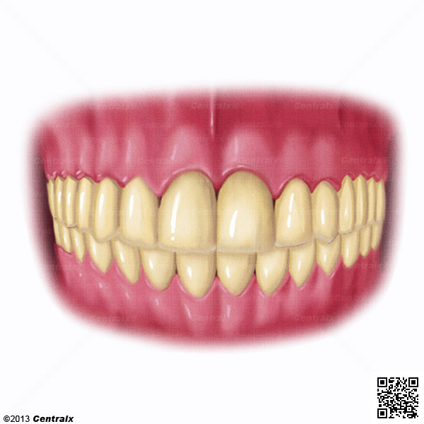 Arcada Ósseo-Dentária