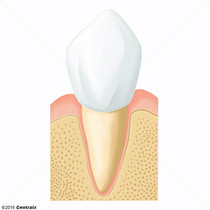 Dente Canino