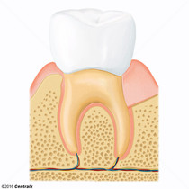 Dente Molar