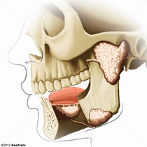 Gl�ndulas Salivares