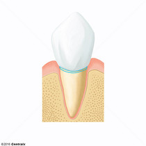Colo do Dente