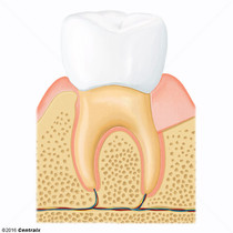 Dente Molar